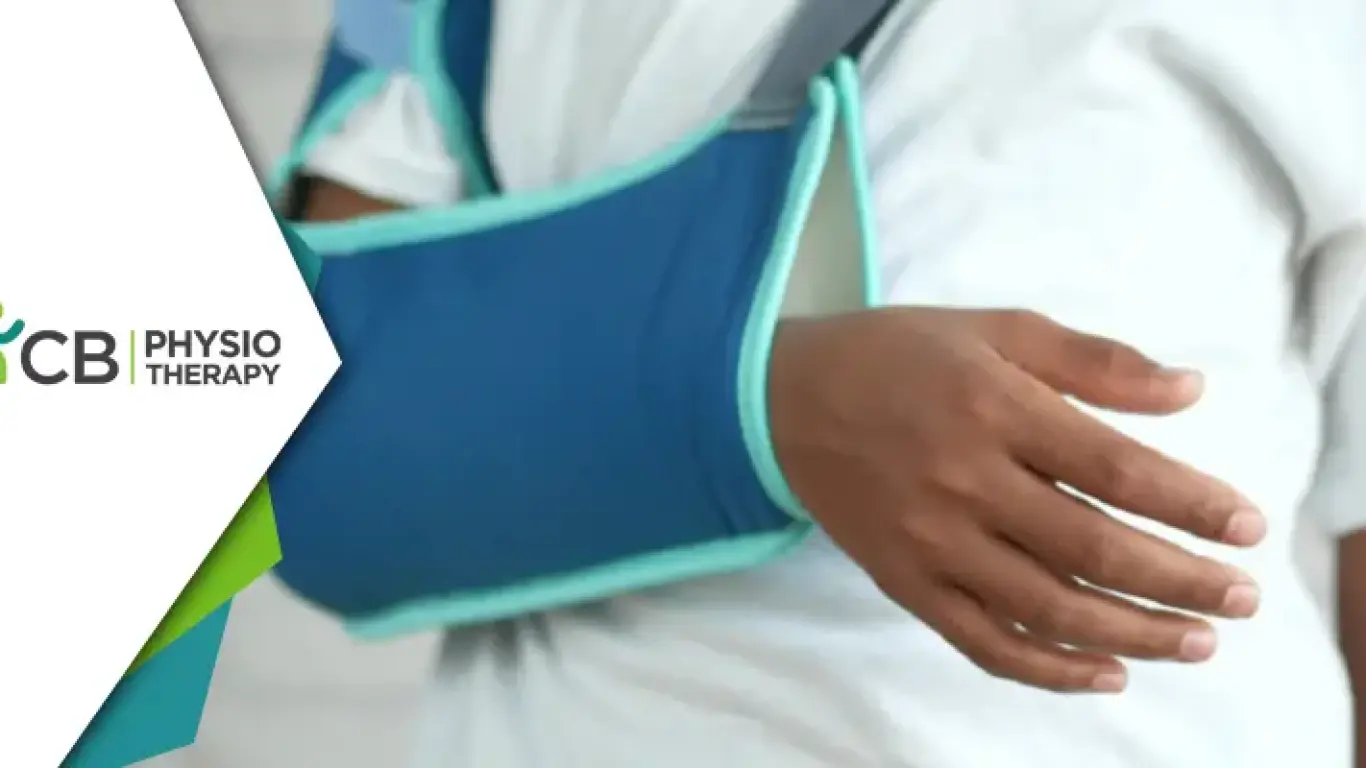 Upper Arm/humerus Fracture : Physiotherapy's Role In Preventing & Managing Claw Hand
