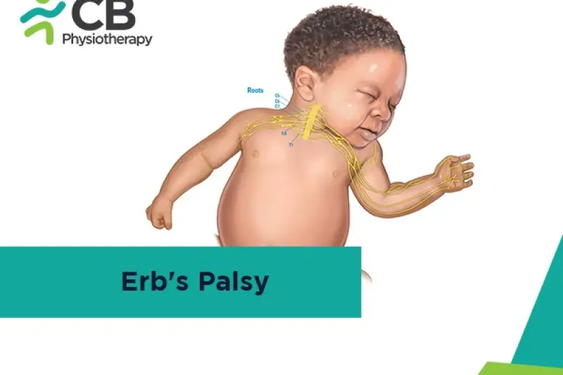 Erb’s Palsy