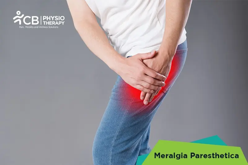 Meralgia Paresthetica