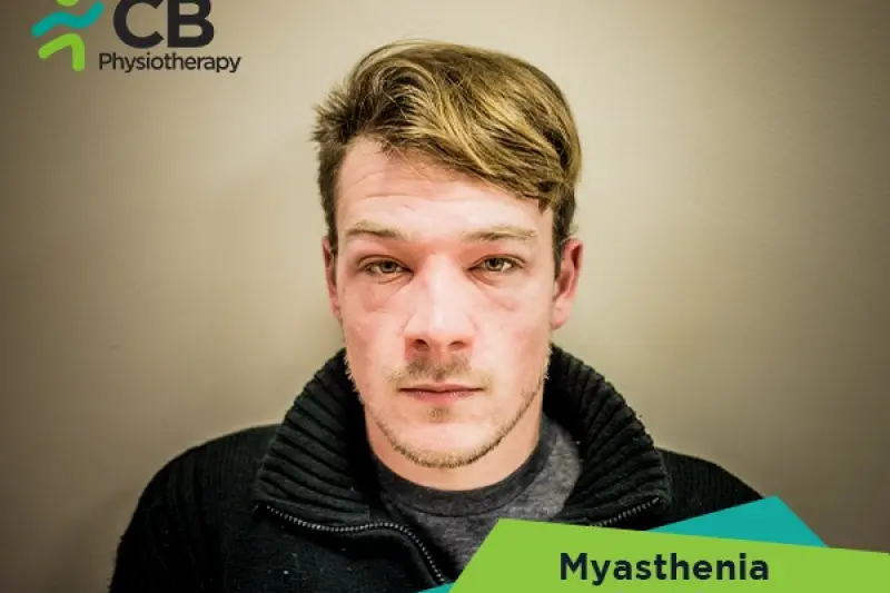 Myasthenia Gravis (mg)