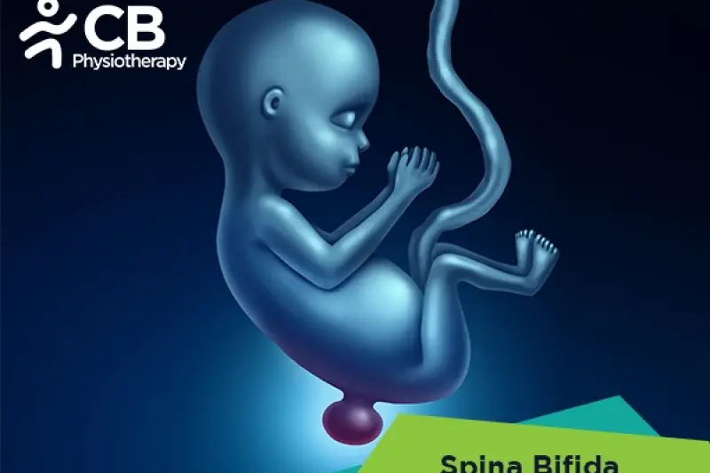 Spina Bifida