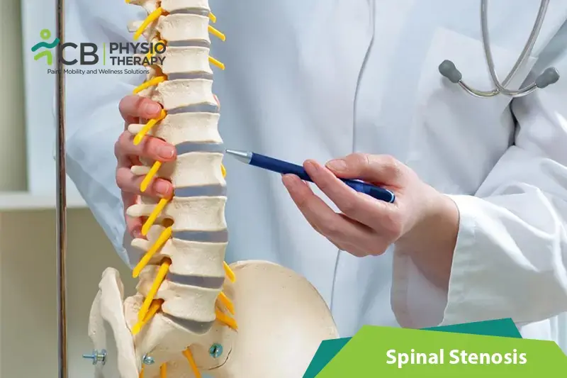 Spinal Stenosis